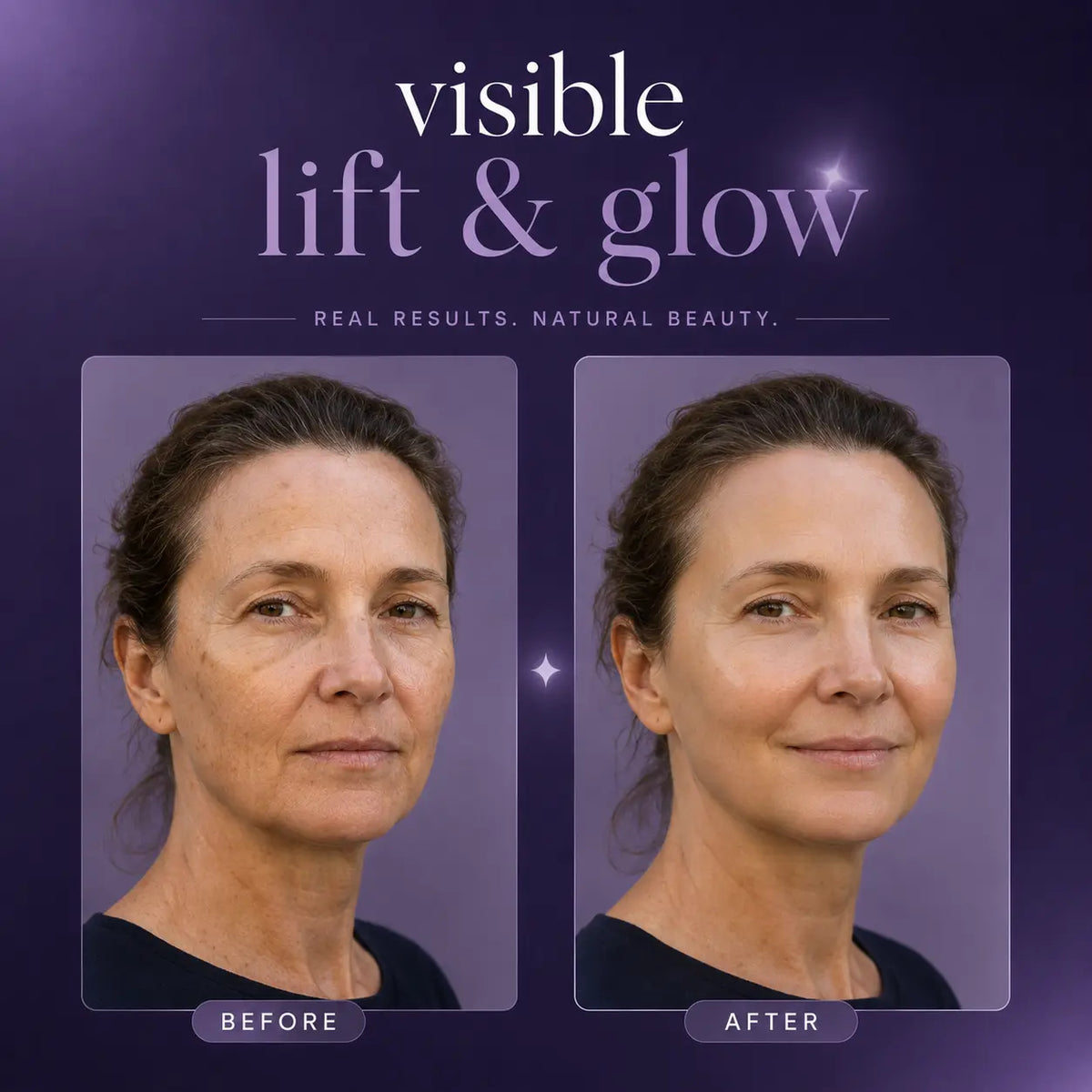 ContourÉlan™ Gesichtsschröpf-Set – Gesicht konturieren, Schwellungen reduzieren & für mehr Glow sorgen