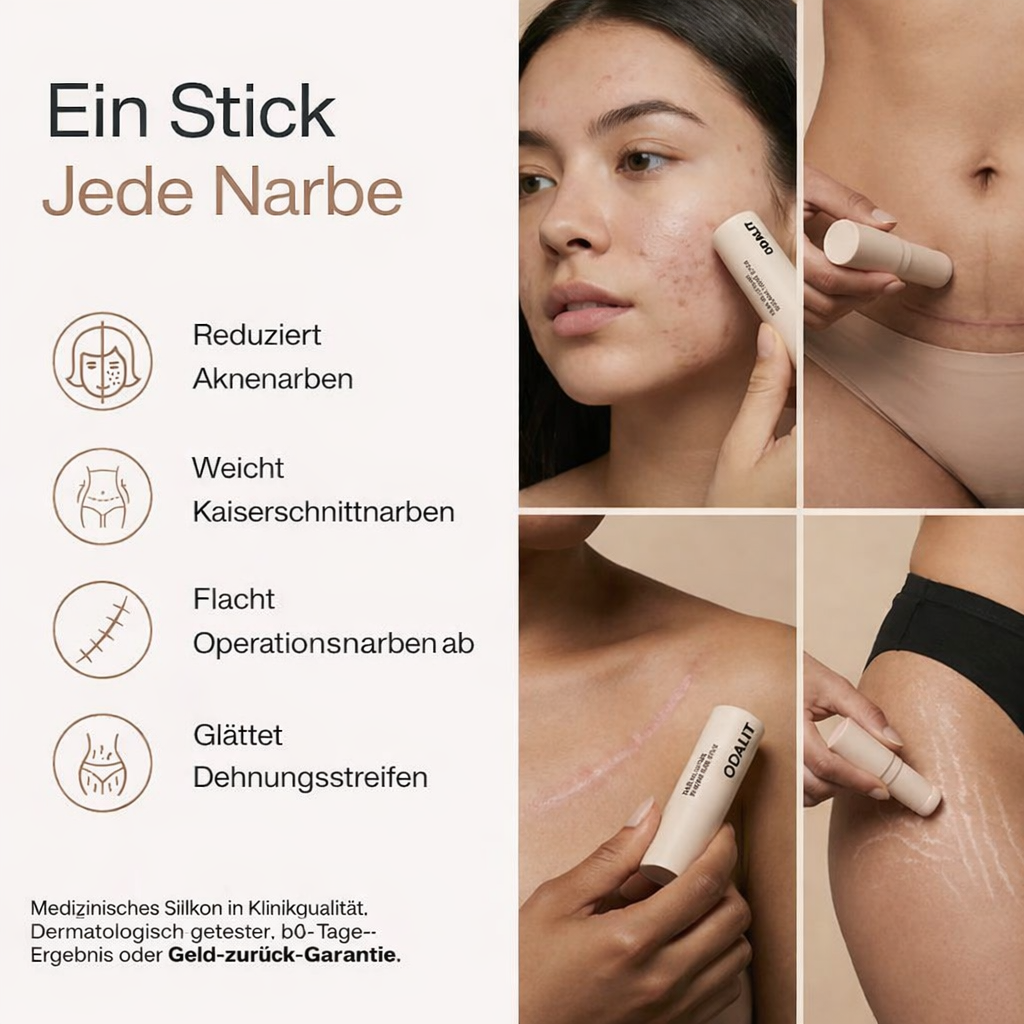ODALIT™ Silikon-Narbenstick – Zeitlich begrenztes Angebot: | 1+1 gratis🔥Letzter Tag⏰