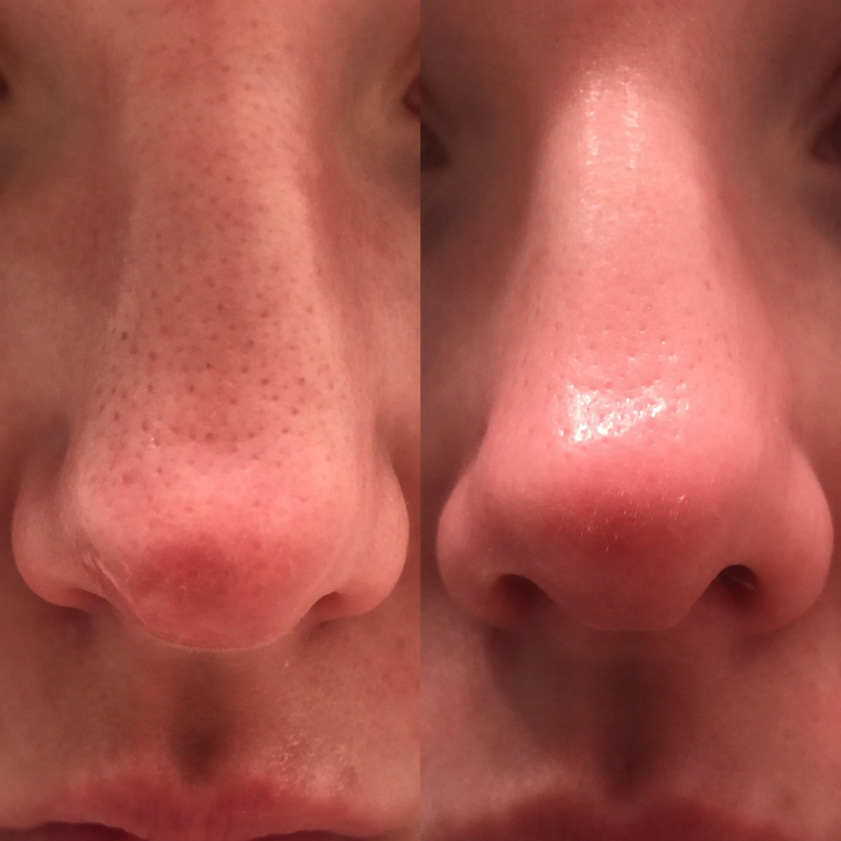 Porevia™ Blackhead Tonerde-Maske – Poren tiefenreinigen, Mitesser entfernen & überschüssigen Talg reduzieren