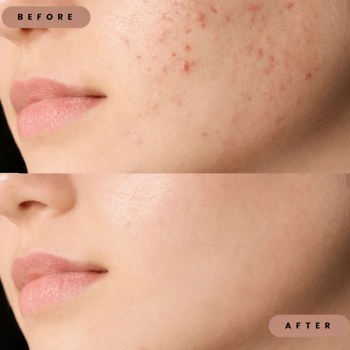 Porevia™ Blackhead Tonerde-Maske – Poren tiefenreinigen, Mitesser entfernen & überschüssigen Talg reduzieren