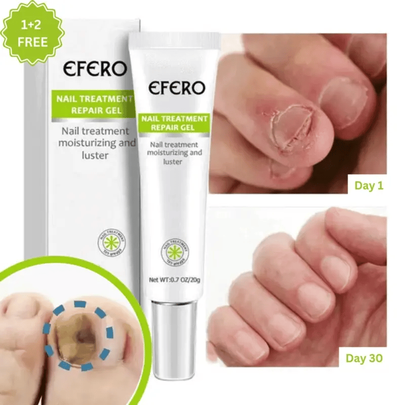 Nagelpflege Gel | Unterstützt Gesünder Aussehende Nägel