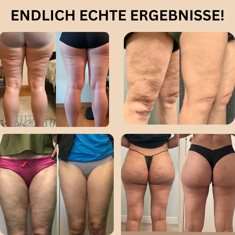 Menora™ | 3D Anti-Cellulite Leggings