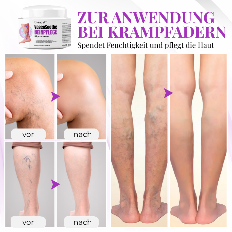 Venalisse™ Beinpflege-Creme – Für Leichtere, Erfrischte & Gepflegt Aussehende Beine