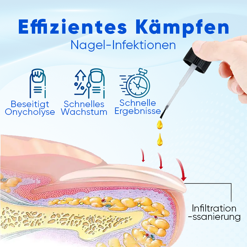 NailViora™ Nagelwachstums- & Reparaturserum – Brüchige Nägel stärken, Onycholyse unterstützen & Nagelwachstum fördern