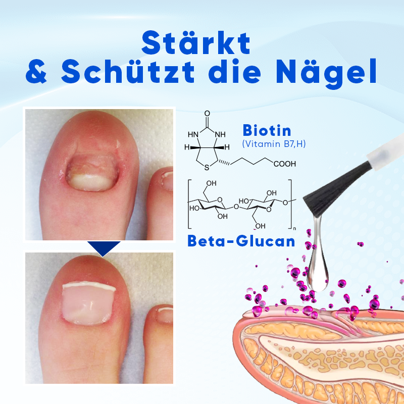 NailViora™ Nagelwachstums- & Reparaturserum – Brüchige Nägel stärken, Onycholyse unterstützen & Nagelwachstum fördern