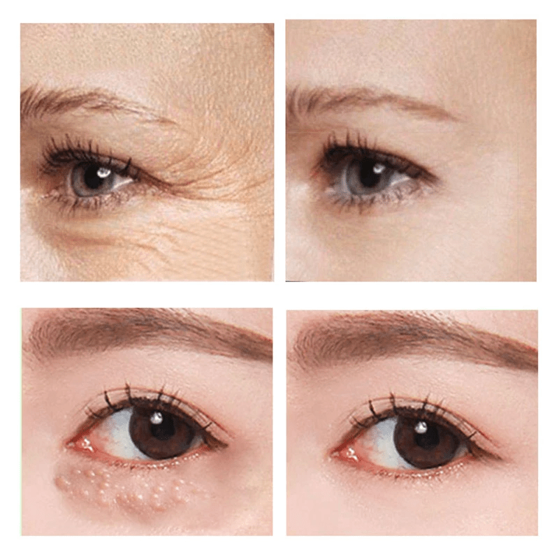 SleekEyes™ - Schnell wirkende straffende Augencreme