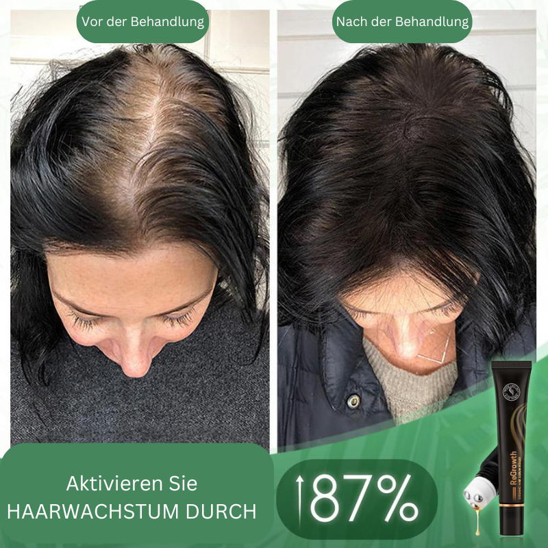 Regrowth™ Bio-Haar-Serum-Roller (1+1 gratis)