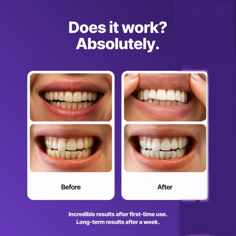 SmileViolet™ Purple Whitening Strips – Für Ein Sichtbar Strahlenderes Lächeln