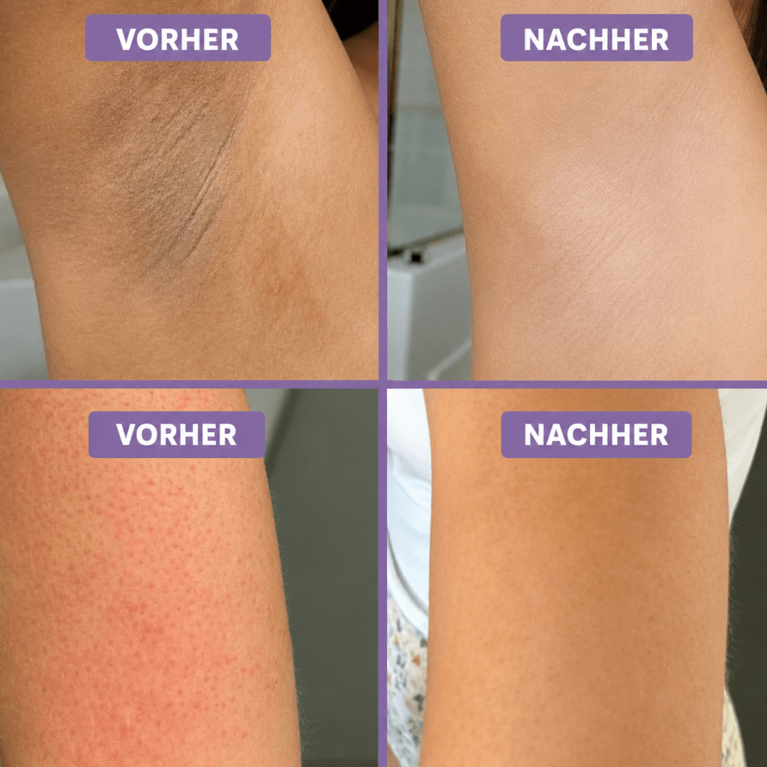 LumiScrub™ Sanftes Körperpeeling mit Kojisäure & Kurkuma