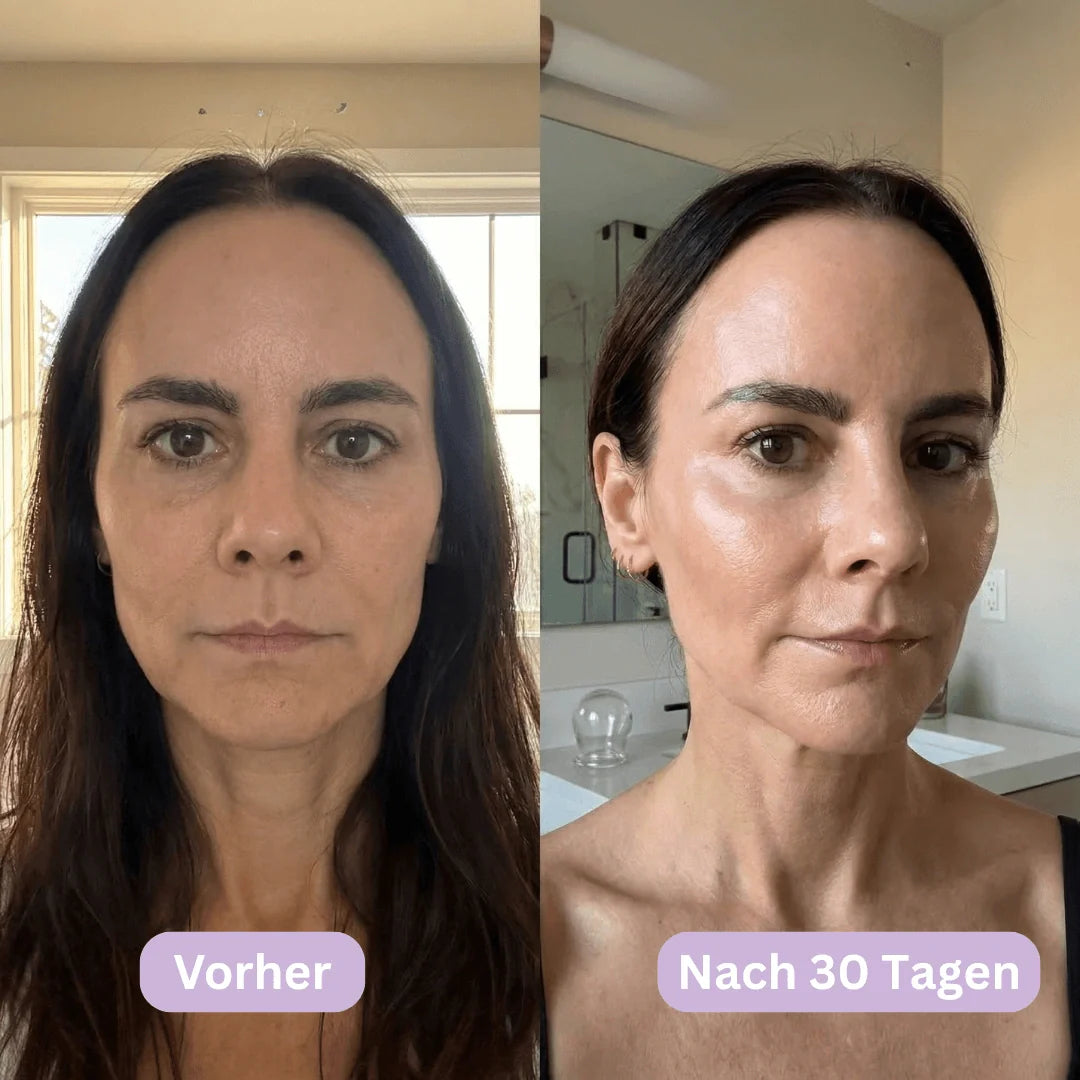 LymphCup™ | Endlich wieder aussehen wie du dich fühlst