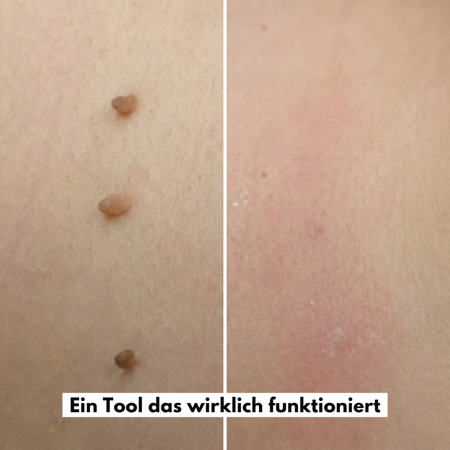 MediClear Plus™ Wieder Wohlfühlen in Deiner Haut