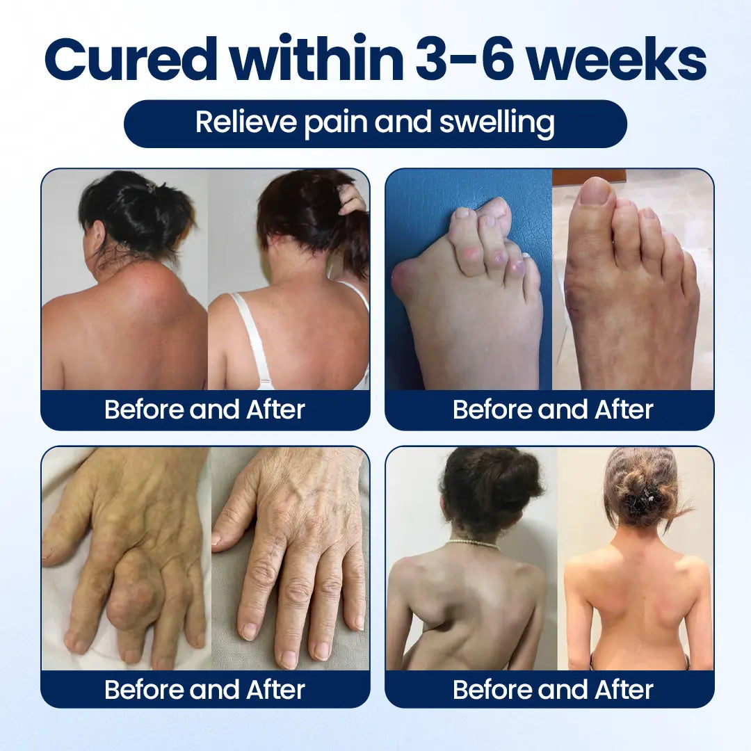 MaxFlexi™ ArthriNAD+ Pro Gelenkcreme – Für mehr Beweglichkeit, Flexibilität & Gelenkkomfort