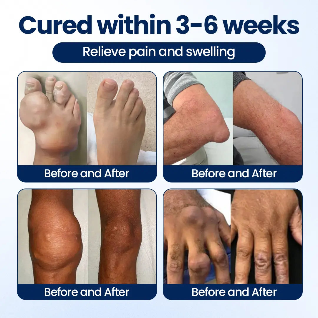 MaxFlexi™ ArthriNAD+ Pro Gelenkcreme – Für mehr Beweglichkeit, Flexibilität & Gelenkkomfort
