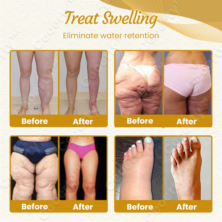 SouthMoon™ | DetoxiSlim Fußbad-Perlen – Ihre natürliche Lösung für gesunde Beine
