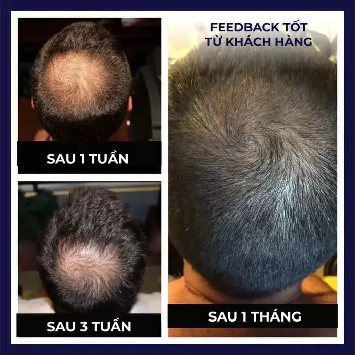 RootRevive™ Natürliches Haarpflege-Spray – Für Voller & Kräftiger Aussehendes Haar