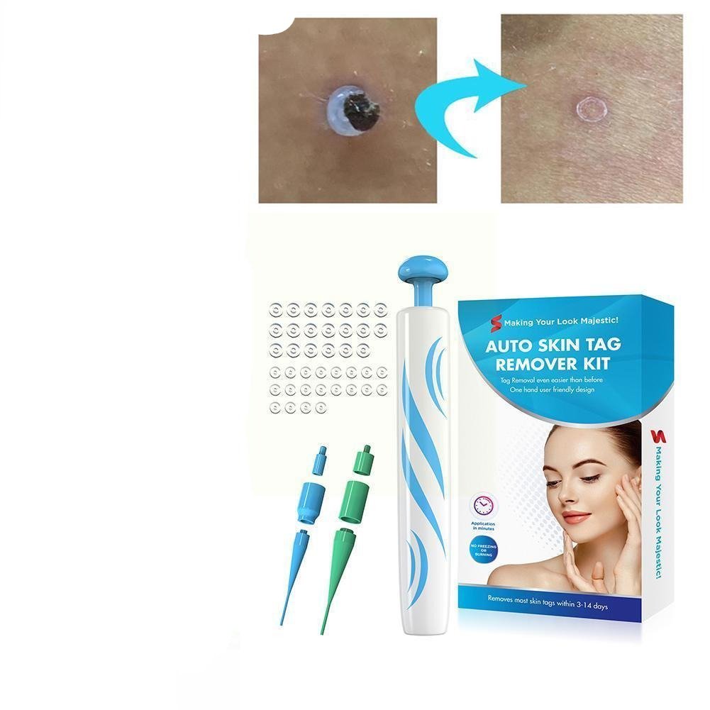 TagFreeza™ Skin Tag Remover – Hautanhängsel schnell, einfach & schmerzfrei entfernen