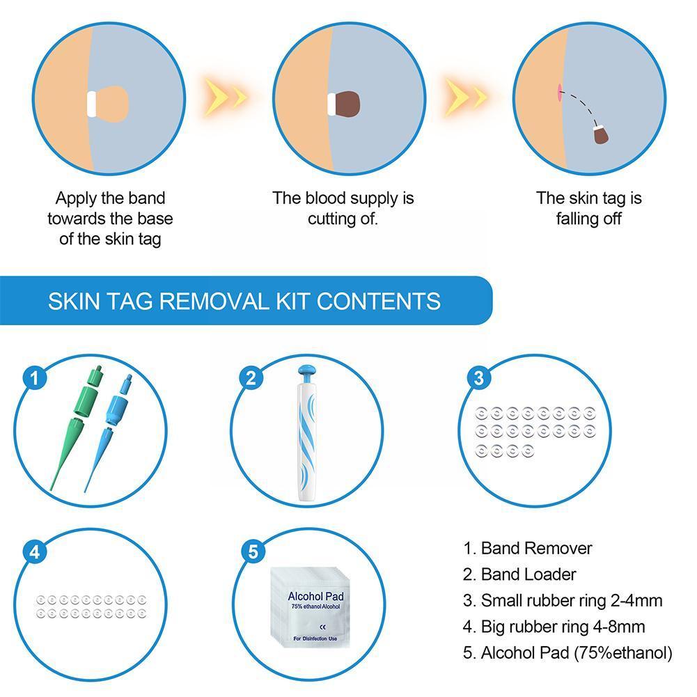 TagFreeza™ Skin Tag Remover – Hautanhängsel schnell, einfach & schmerzfrei entfernen