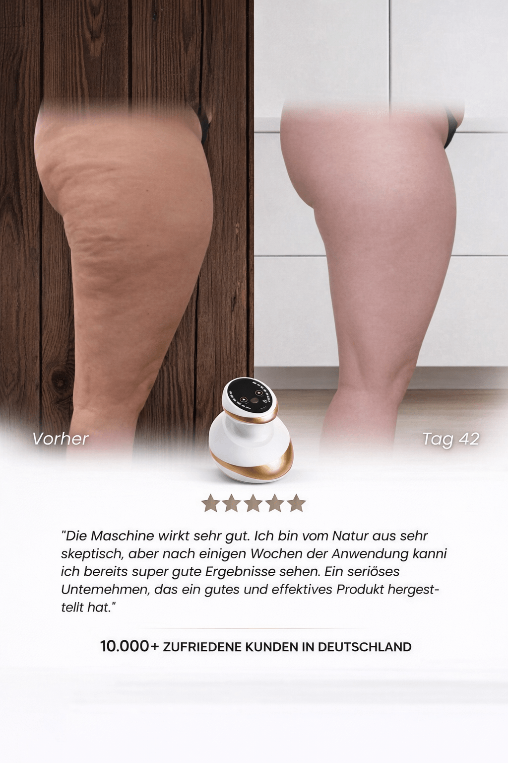 Velunara™ Anti-Cellulite-Massagegerät – Für sichtbar glattere & straffere Haut