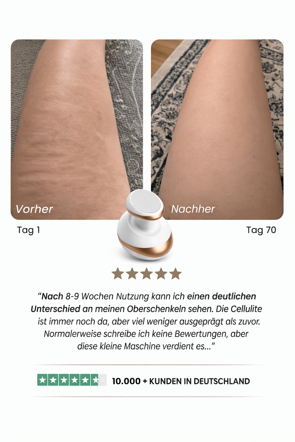 Velunara™ Anti-Cellulite-Massagegerät – Für sichtbar glattere & straffere Haut