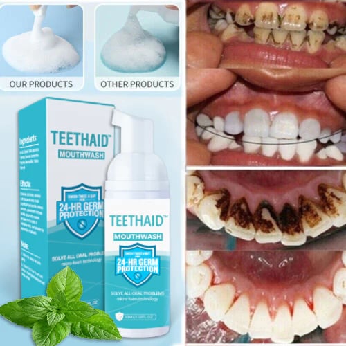 🔥 50% RABATT | BrightMint™ Premium Mundspülung – Für Frischen Atem & Strahlend Gepflegte Zähne