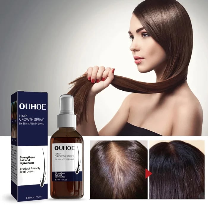 RootRevive™ Natürliches Haarpflege-Spray – Für Voller & Kräftiger Aussehendes Haar