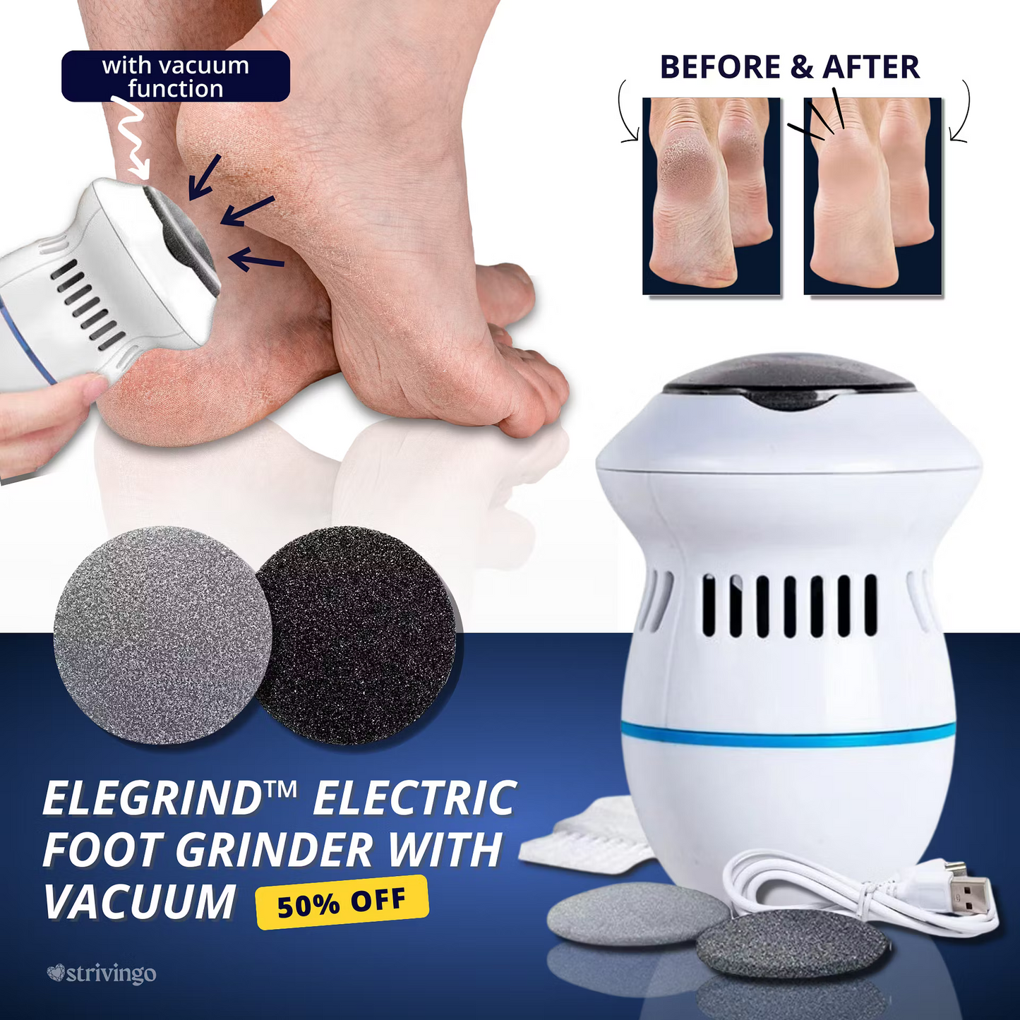 🔥 50% RABATT | ELEGRIND™ Elektrischer Hornhautentferner mit Vakuum – Für seidig glatte Füße