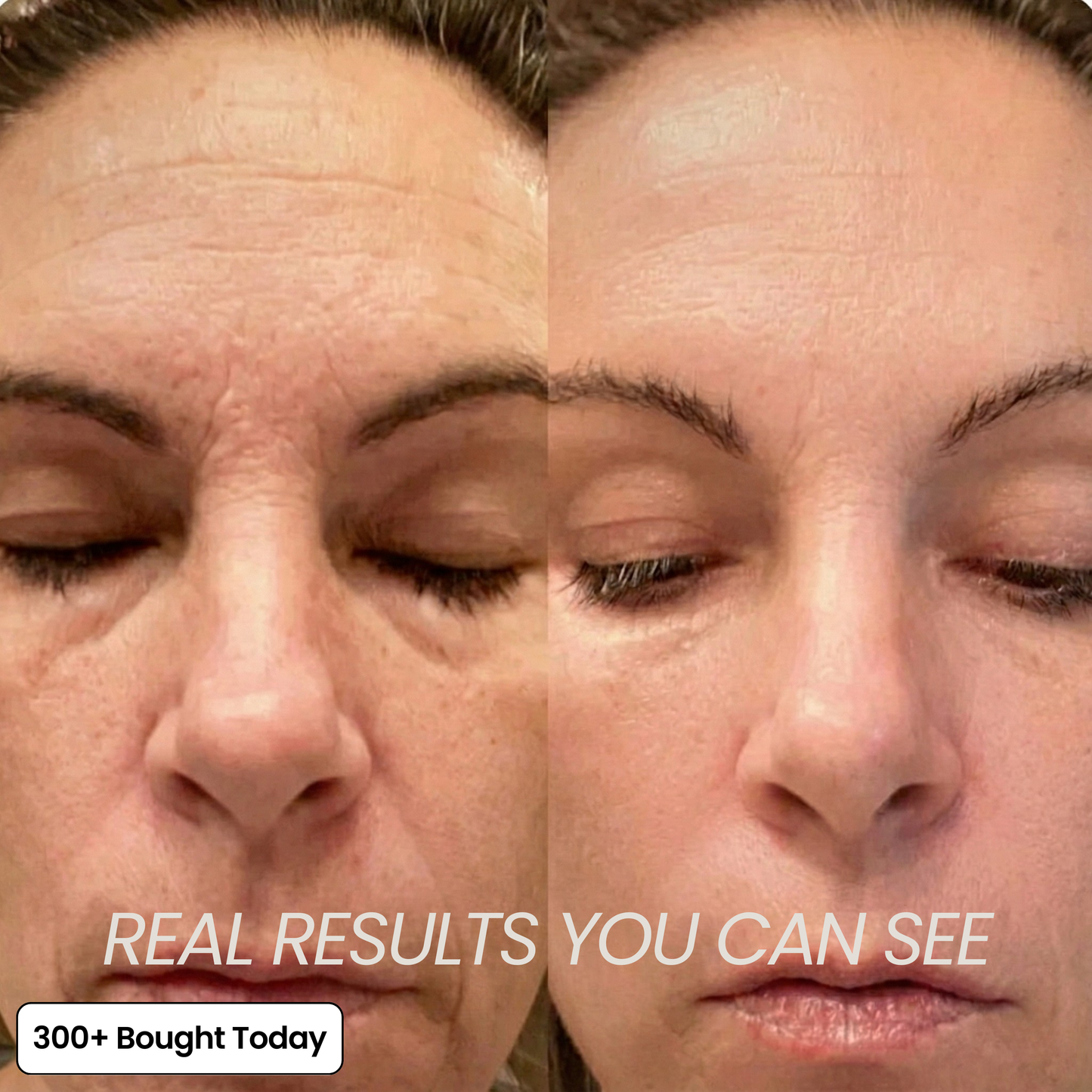 VoluDerm™ | Plump & Repair Collagen Balm – Volufiline & PDRN für vollere, glattere Haut
