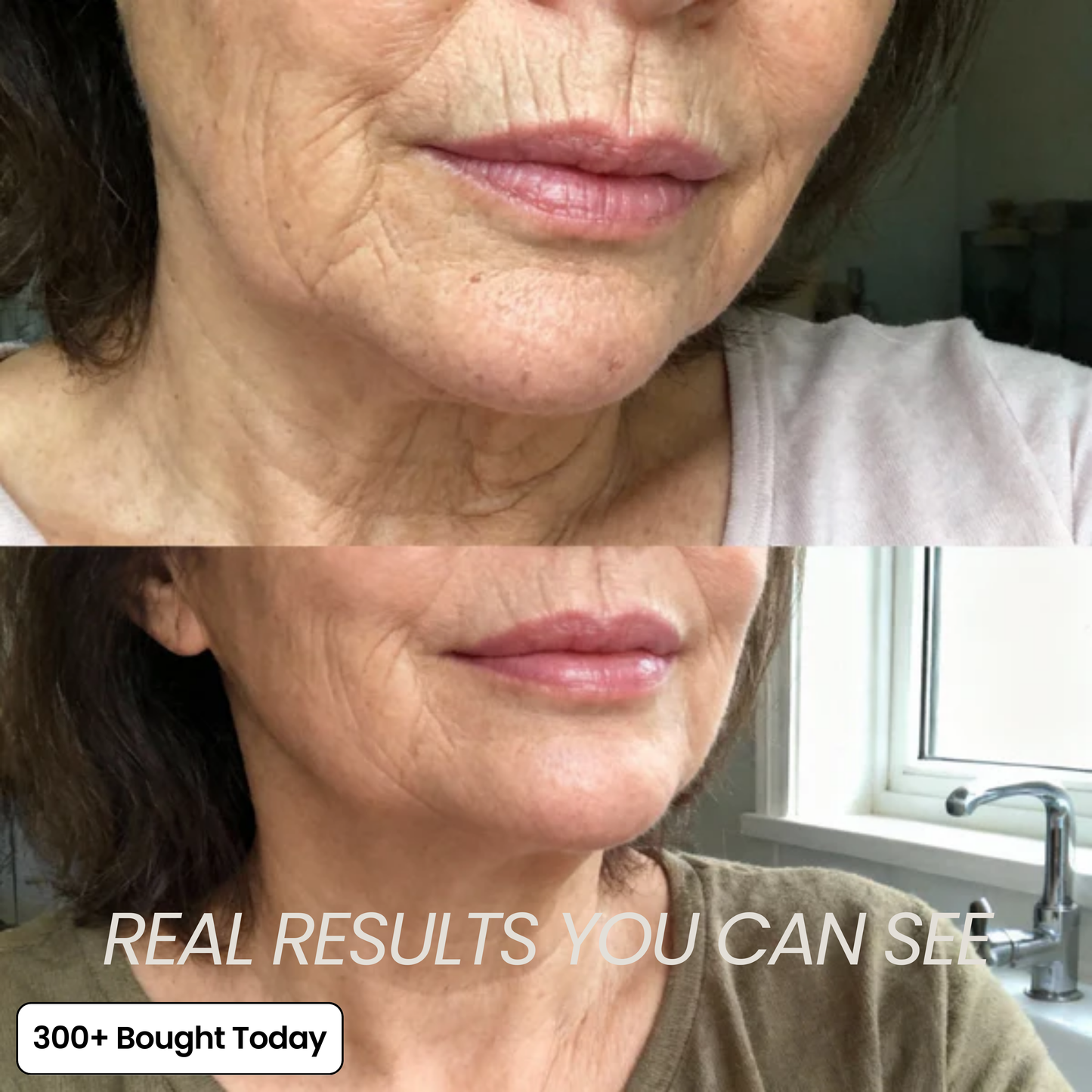 VoluDerm™ | Plump & Repair Collagen Balm – Volufiline & PDRN für vollere, glattere Haut
