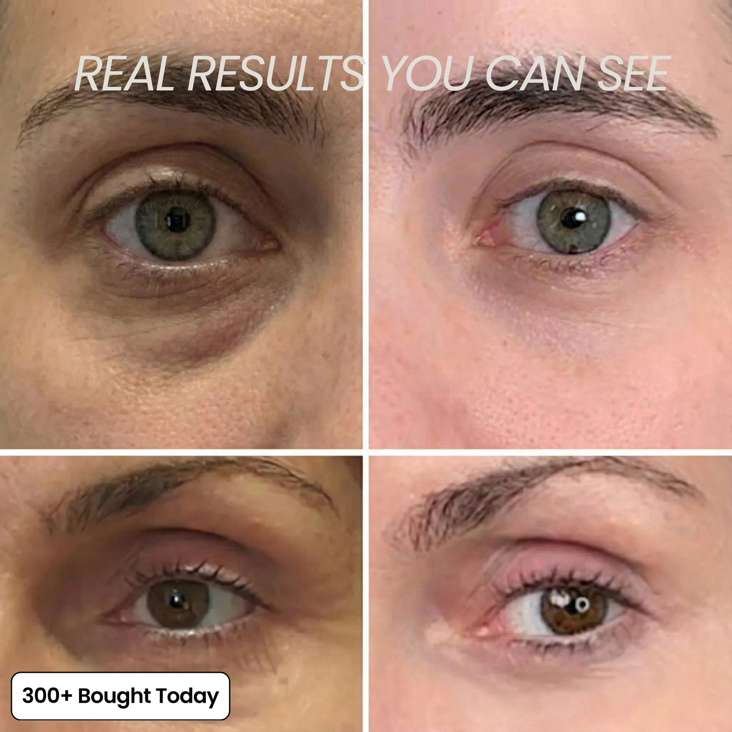 VoluDerm™ | Plump & Repair Collagen Balm – Volufiline & PDRN für vollere, glattere Haut