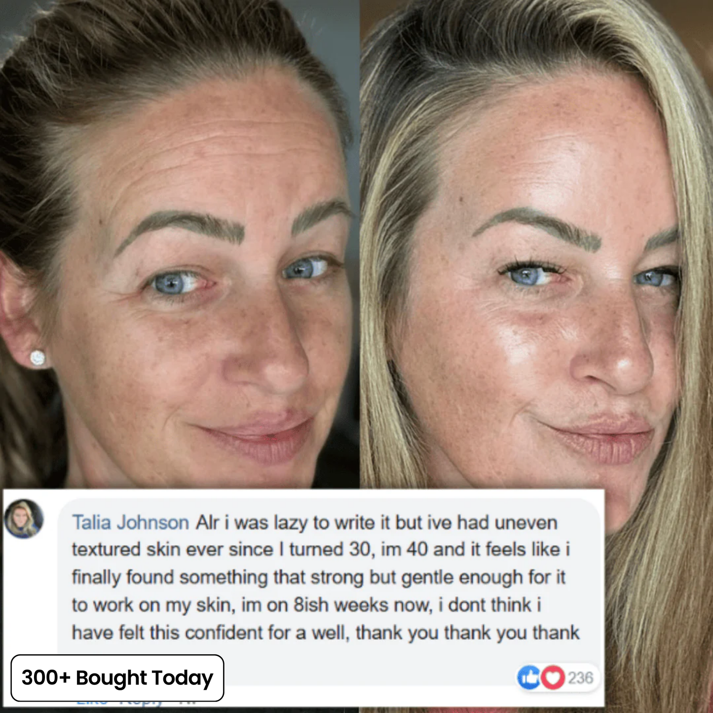 VoluDerm™ | Plump & Repair Collagen Balm – Volufiline & PDRN für vollere, glattere Haut