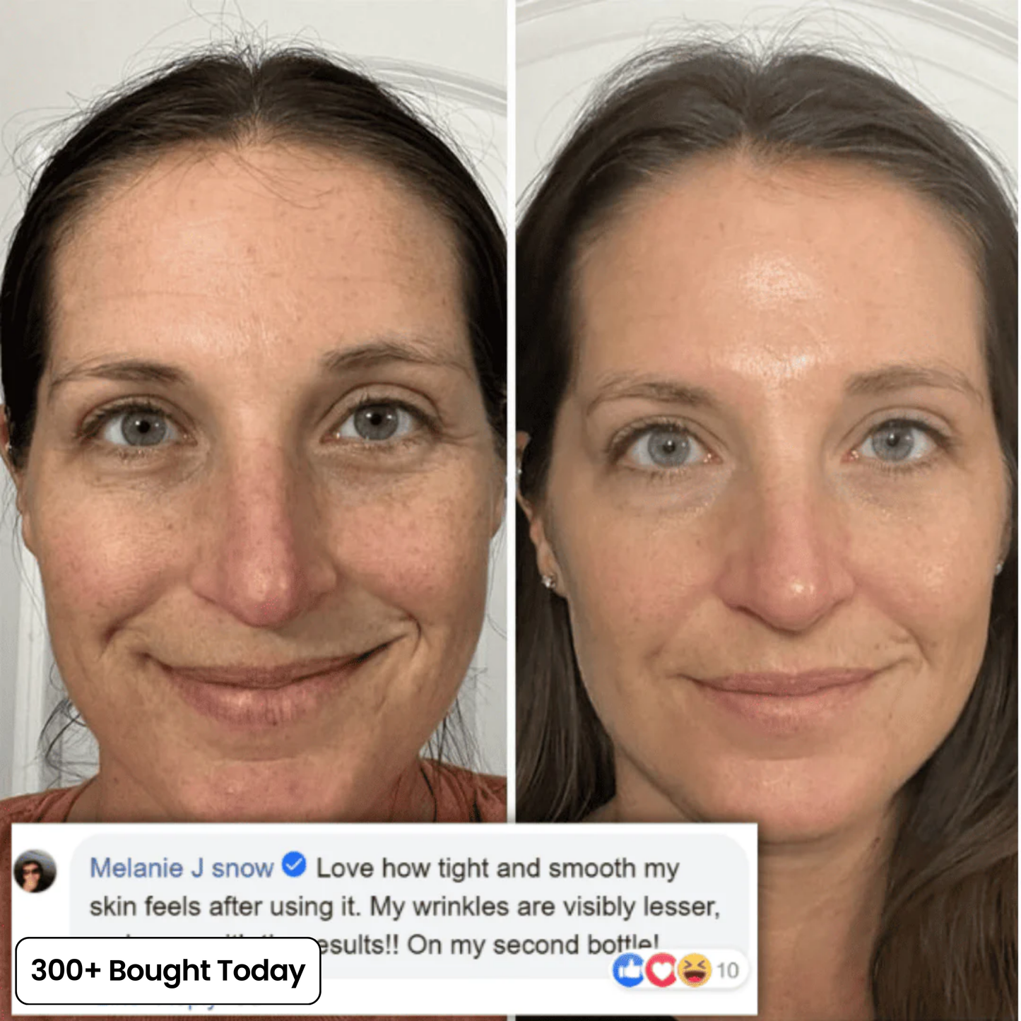 VoluDerm™ | Plump & Repair Collagen Balm – Volufiline & PDRN für vollere, glattere Haut