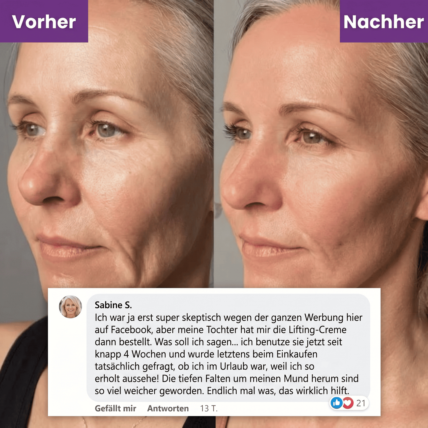 Veluna Lifting Creme (17-Peptide-Komplex)