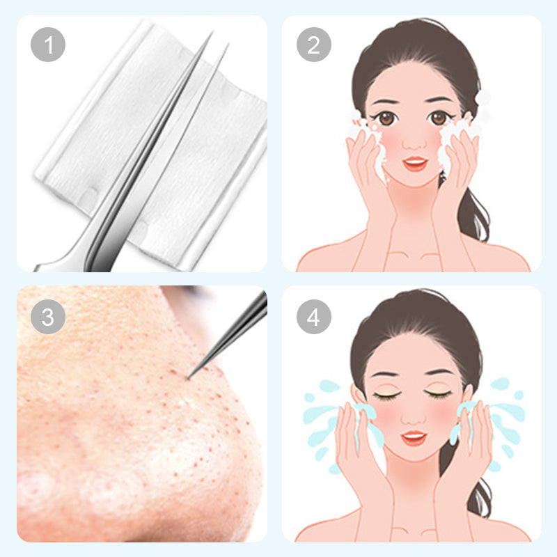 💓 Letzter Tag Rabatt 💥 Medizinische Mitesser-Pinzettenset（7-teiliges Set）