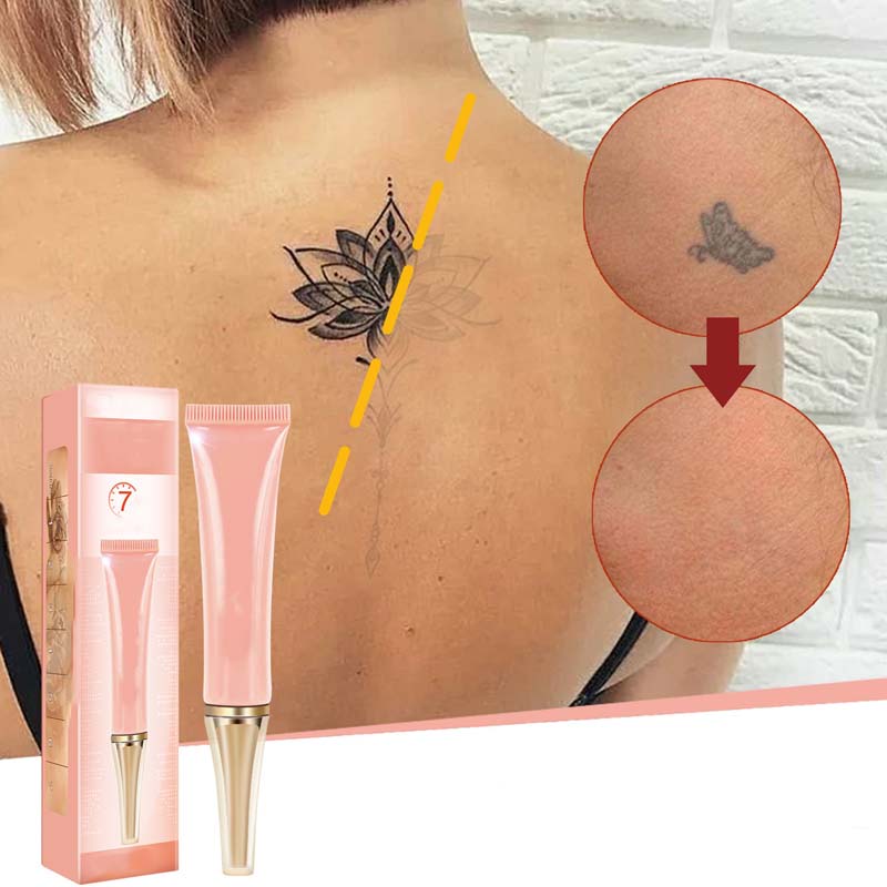 InkLuma™ Tattoo Fade Creme – Für Ein Gleichmäßigeres Verblassen Unerwünschter Tattoos