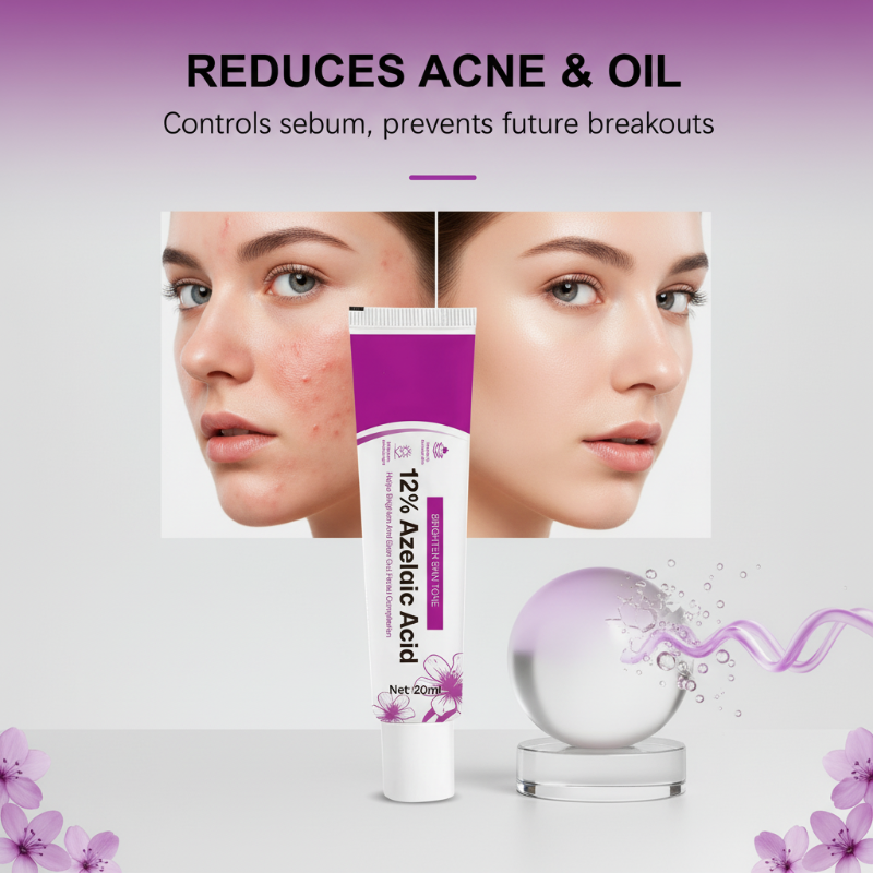 Azelura™ 12% Azelainsäure-Creme – Für Ein Klareres & Ebenmäßigeres Hautbild