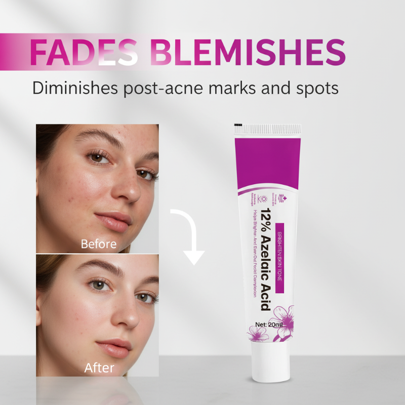 Azelura™ 12% Azelainsäure-Creme – Für Ein Klareres & Ebenmäßigeres Hautbild