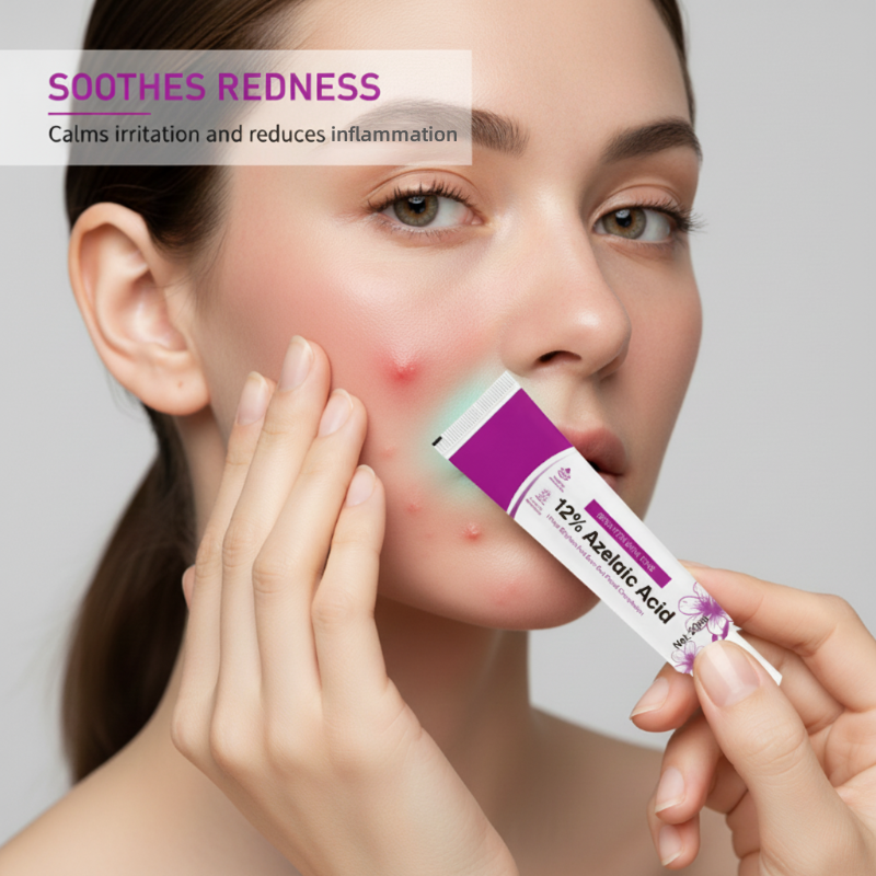 Azelura™ 12% Azelainsäure-Creme – Für Ein Klareres & Ebenmäßigeres Hautbild