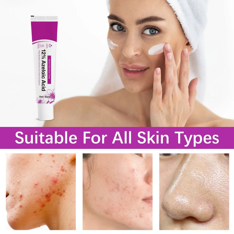 Azelura™ 12% Azelainsäure-Creme – Für Ein Klareres & Ebenmäßigeres Hautbild