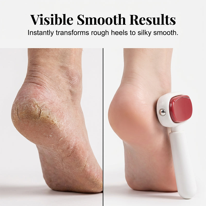 1+1 GRATIS | SoleSmooth™ 2-in-1 Fußhorn – Für glatte, weiche Füße ohne Hornhaut