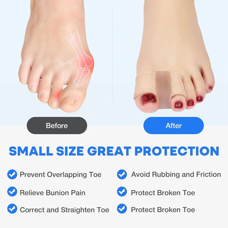 🔥 50% RABATT | ToeSnap™ Hallux-Valgus-Korrektor