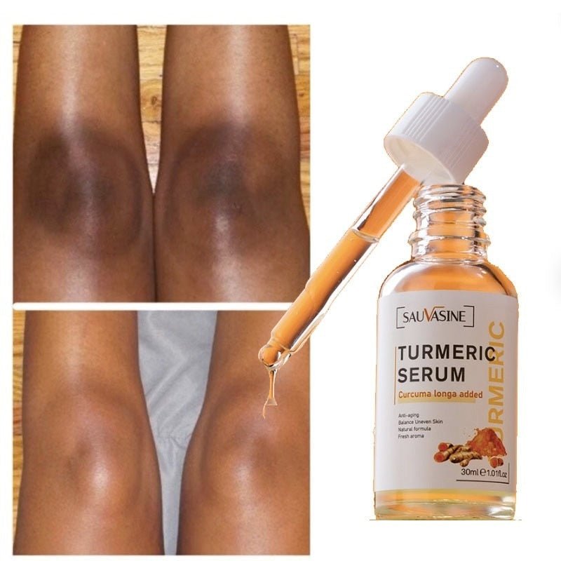 TurmiGlow™ Dark Spot Corrector Serum – Gegen Pigmentflecken, für ebenmäßige & strahlende Haut