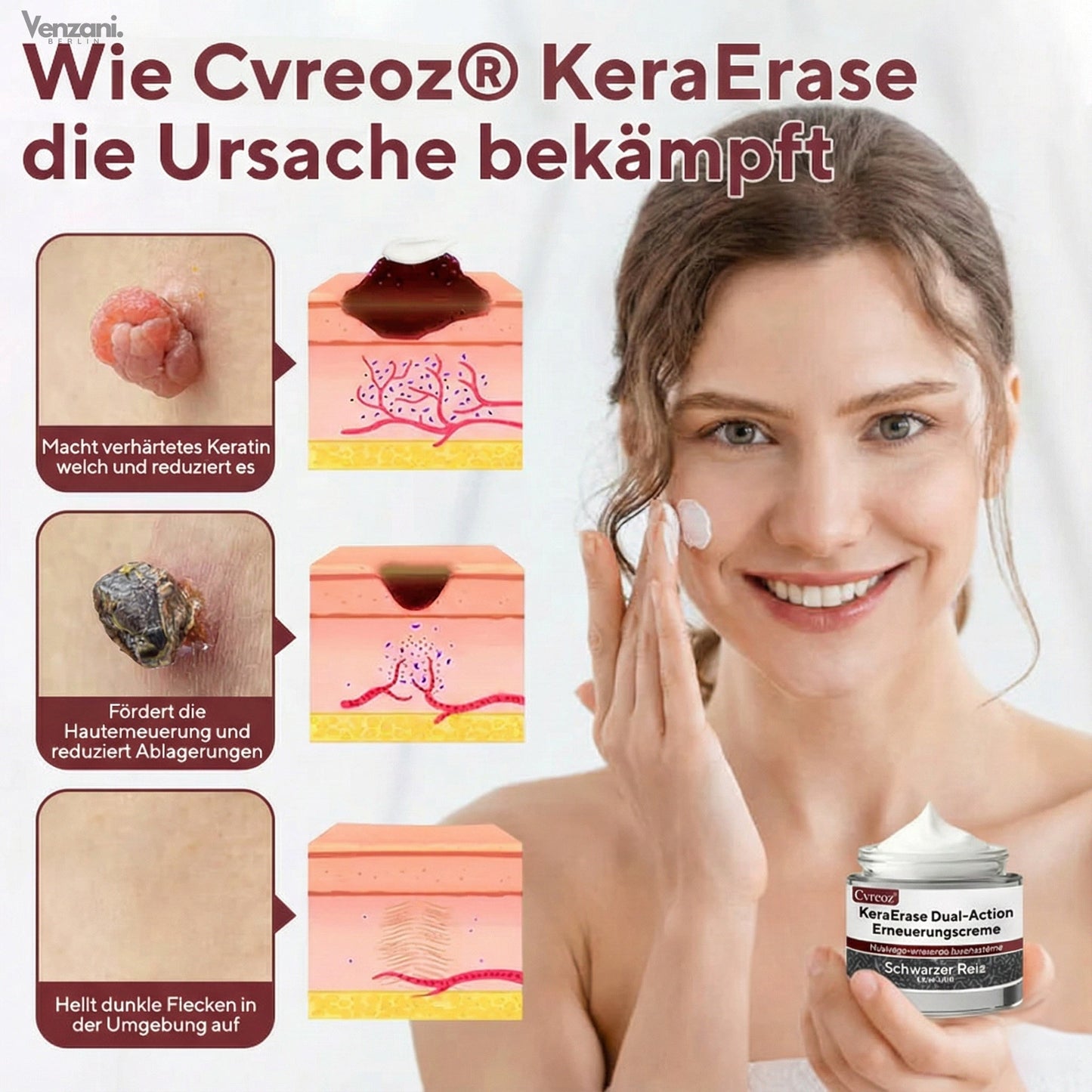 Cvreoz® KeraErase Dual-Action Erneuerungscreme | Die Kraft aus Schwarzem Reis gegen raue Stellen