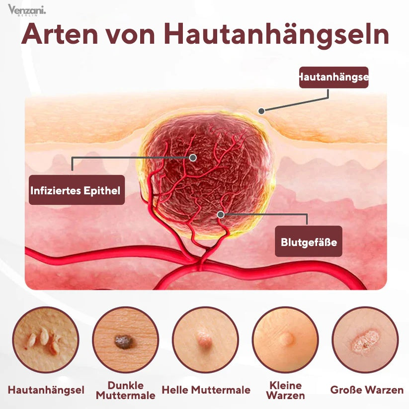 Cvreoz® KeraErase Dual-Action Erneuerungscreme | Die Kraft aus Schwarzem Reis gegen raue Stellen