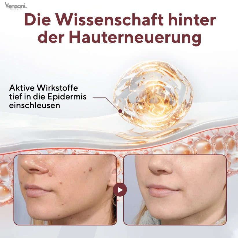 Cvreoz® KeraErase Dual-Action Erneuerungscreme | Die Kraft aus Schwarzem Reis gegen raue Stellen